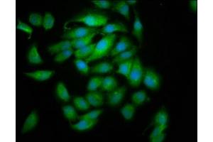 Immunofluorescence staining of A549 cells with ABIN7153444 at 1:133, counter-stained with DAPI. (Galectin 10 抗体  (AA 2-142))