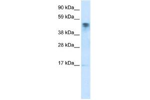 WB Suggested Anti-FLJ13798 Antibody Titration:  0.
