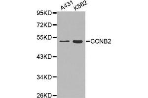 Western Blotting (WB) image for anti-Cyclin B2 (CCNB2) antibody (ABIN1871537) (Cyclin B2 抗体)