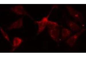 ABIN6275891 staining  HeLa cells by IF/ICC. (NR1I2 抗体  (Internal Region))