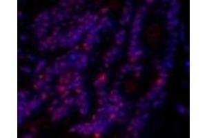 Immunofluorescence analysis of Rat lung tissue using SIRT1 Polyclonal Antibody at dilution of 1:200. (SIRT1 抗体)