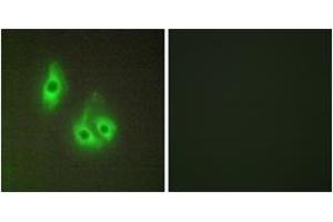 Immunofluorescence analysis of HepG2 cells, using LAMA3 Antibody. (LAMA3 抗体  (AA 2571-2620))