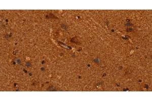 Immunohistochemistry of paraffin-embedded Human brain tissue using ALG11 Polyclonal Antibody at dilution 1:40 (ALG11 抗体)