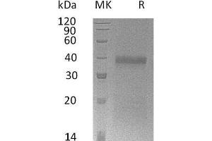 IGFBP5 Protein (His tag)