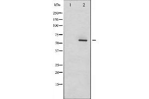 Western blot analysis of Dab1 phosphorylation expression in LOVO whole cell lysates,The lane on the left is treated with the antigen-specific peptide. (DAB1 抗体  (pTyr232))
