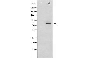 Western blot analysis of Dab1 phosphorylation expression in LOVO whole cell lysates,The lane on the left is treated with the antigen-specific peptide. (DAB1 抗体  (pTyr232))