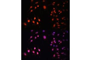 Immunofluorescence analysis of C6 cells using SETD2 Polyclonal Antibody (ABIN3017564, ABIN3017565, ABIN1682666 and ABIN6220156) at dilution of 1:100 (40x lens). (SETD2 抗体  (AA 803-1103))