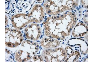 Immunohistochemical staining of paraffin-embedded liver tissue using anti-HDAC10mouse monoclonal antibody. (HDAC10 抗体)
