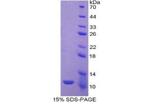 SDS-PAGE analysis of Rat IDO Protein. (IDO 蛋白)