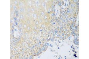 Immunohistochemistry of paraffin-embedded Human esophagus using DHODH Polyclonal Antibody at dilution of 1:100 (40x lens). (DHODH 抗体)