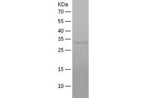 Western Blotting (WB) image for Retinol Binding Protein 3, Interstitial (RBP3) (AA 321-630) protein (His tag) (ABIN7124850)