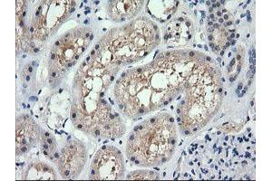 Image no. 1 for anti-Retinoic Acid Receptor Responder (Tazarotene Induced) 1 (RARRES1) antibody (ABIN1500604) (RARRES1 抗体)