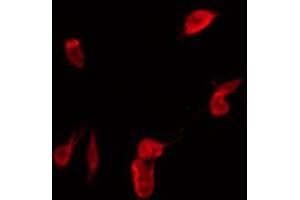 ABIN6267483 staining COS7 by IF/ICC. (IRS1 抗体  (pSer307))