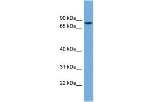 WB Suggested Anti-CRTAC1 Antibody Titration: 0.