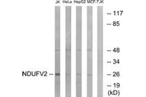 Western blot analysis of extracts from Jurkat/HeLa/HepG2/MCF-7 cells, using NDUFV2 Antibody. (NDUFV2 抗体  (AA 20-69))