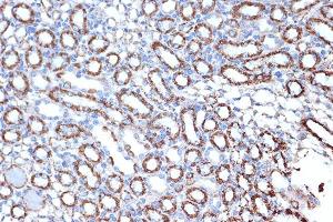 Immunohistochemistry (IHC) image for anti-Heat Shock 10kDa Protein 1 (Chaperonin 10) (HSPE1) antibody (ABIN7267567)