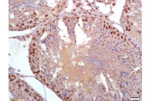 Formalin-fixed and paraffin embedded rat testis labeled with Anti-Parkin protein/PARK2 Polyclonal Antibody, Unconjugated (ABIN735578) at 1:200 followed by conjugation to the secondary antibody and DAB staining (Parkin 抗体  (AA 361-465))