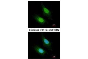 ICC/IF Image Immunofluorescence analysis of paraformaldehyde-fixed HeLa, using ZC3H12A, antibody at 1:200 dilution. (ZC3H12A 抗体)