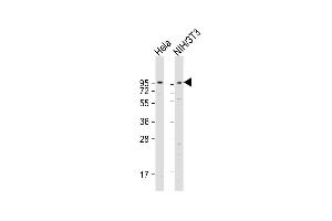 Western Blotting (WB) image for anti-Dystroglycan 1 (DAG1) (AA 718-747), (C-Term) antibody (ABIN658022)