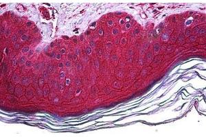 Human Skin: Formalin-Fixed, Paraffin-Embedded (FFPE) (FBXO11 抗体  (AA 744-844))