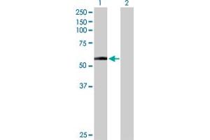 Western Blot analysis of DDC expression in transfected 293T cell line by DDC MaxPab polyclonal antibody. (DDC 抗体  (AA 1-480))