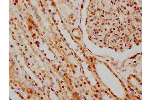 Immunohistochemistry (IHC) image for anti-Heterogeneous Nuclear Ribonucleoprotein C (C1/C2) (HNRNPC) antibody (ABIN7127547)
