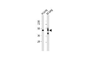 All lanes : Anti-hAGER-K44 at 1:2000 dilution Lane 1: Human lung lysate Lane 2: Mouse lung lysate Lysates/proteins at 20 μg per lane. (RAGE 抗体  (N-Term))