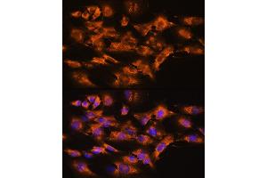 Immunofluorescence analysis of NIH/3T3 cells using  Rabbit pAb (ABIN3021619, ABIN3021620, ABIN3021621 and ABIN6215402) at dilution of 1:100.