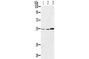 Western Blotting (WB) image for anti-Sestrin 2 (SESN2) antibody (ABIN2433787) (Sestrin 2 抗体)
