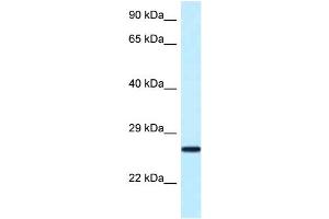 WB Suggested Anti-Nudt16 Antibody Titration: 1.