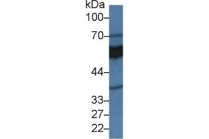 Detection of MAOA in Rat Kidney lysate using Polyclonal Antibody to Monoamine Oxidase A (MAOA) (Monoamine Oxidase A 抗体  (AA 2-497))