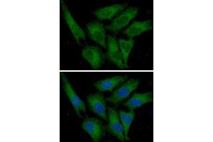 ICC/IF analysis of PAI1 in HeLa cells line, stained with DAPI (Blue) for nucleus staining and monoclonal anti-human PAI1 antibody (1:100) with goat anti-mouse IgG-Alexa fluor 488 conjugate (Green)