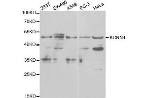 Western blot analysis of extracts of various cell lines, using KCNN4 antibody. (KCNN4 抗体  (AA 288-427))
