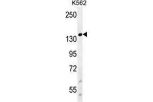 WRN Antibody (Center T802) western blot analysis in K562 cell line lysates (35 µg/lane). (RECQL2 抗体  (Middle Region, Thr802))