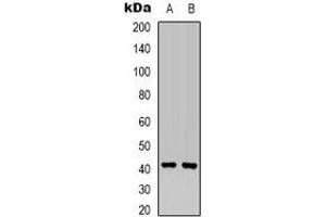 Western blot analysis of MKK6 expression in Hela (A), HEK293T (B) whole cell lysates. (MAP2K6 抗体  (N-Term))