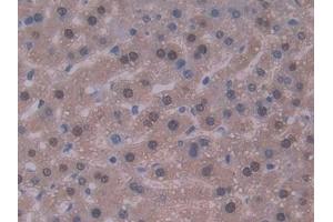 Detection of IL22 in Mouse Liver Tissue using Polyclonal Antibody to Interleukin 22 (IL22) (IL-22 抗体  (AA 34-179))