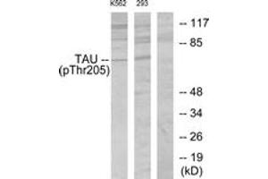 Western blot analysis of extracts from K562 cells and 293 cells, using Tau (Phospho-Thr205) Antibody. (tau 抗体  (pThr522))
