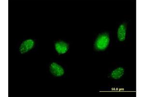 Immunofluorescence of purified MaxPab antibody to HNF4A on HeLa cell. (HNF4A 抗体  (AA 1-464))