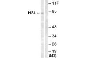 Western blot analysis of extracts from HeLa cells, treated with Calyculin A 100nM 30', using HSL (Ab-554) Antibody. (LIPE 抗体  (AA 520-569))
