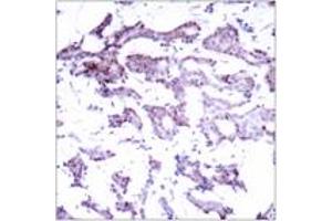 Immunohistochemistry (IHC) image for anti-ELK1, Member of ETS Oncogene Family (ELK1) (AA 356-405) antibody (ABIN2888979) (ELK1 抗体  (AA 356-405))