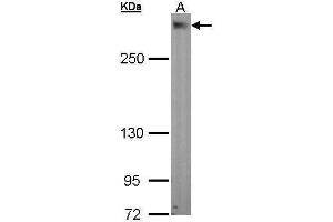WB Image Sample (30 ug of whole cell lysate) A: A549 5% SDS PAGE antibody diluted at 1:1000 (PDZD2 抗体  (N-Term))