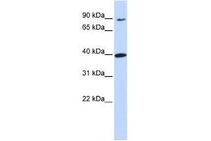 OR11H12 antibody used at 1 ug/ml to detect target protein.