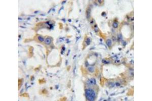 Used in DAB staining on fromalin fixed paraffin-embedded pancreas tissue