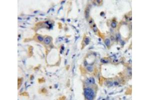 Used in DAB staining on fromalin fixed paraffin-embedded pancreas tissue (TWEAK 抗体  (AA 53-249))