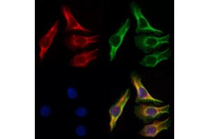 ABIN6257681 and ABIN6274187 staining Hela by IF/ICC. (ADRA2C 抗体  (Internal Region))