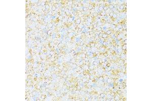 Immunohistochemistry of paraffin-embedded rat ovary using UQCR10 antibody (ABIN6132851, ABIN6149956, ABIN6149958 and ABIN6216272) at dilution of 1:100 (40x lens). (UQCR10 抗体  (AA 1-63))