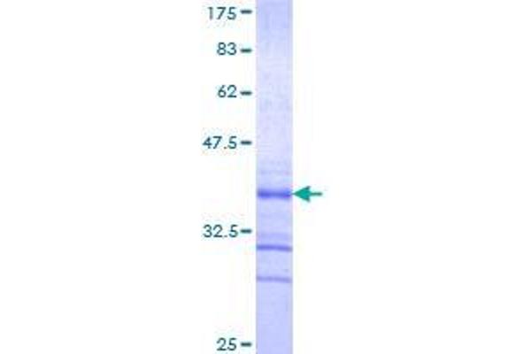 RFFL Protein (AA 2-99) (GST tag)