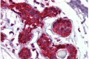 Immunohistochemistry (Formalin-fixed Paraffin-embedded Sections) (IHC (fp)) image for anti-Eukaryotic Translation Initiation Factor 4E Binding Protein 1 (EIF4EBP1) (AA 101-118) antibody (ABIN462434)