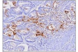 Immunohistochemistry (IHC) image for anti-Fatty Acid Binding Protein 1, Liver (FABP1) (AA 1-127), (N-Term) antibody (ABIN317518)
