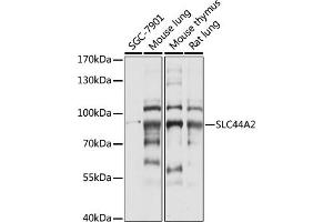 Western blot analysis of extracts of various cell lines, using SLC44 antibody (ABIN7270464) at 1:1000 dilution. (SLC44A2 抗体  (AA 150-250))